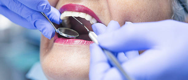 Best Emergency Dental Care for Broken or Chipped Teeth in Richmond, VA